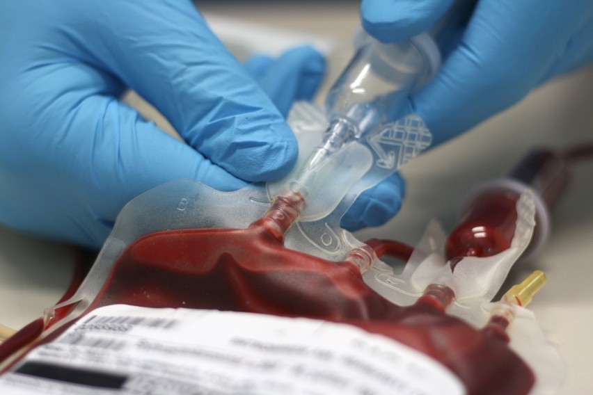 Jakie zasady obowiązują osoby, które chcą oddać krew?