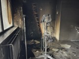 Pożar w kaliskim szpitalu. Jedna osoba poszkodowana. ZDJĘCIA