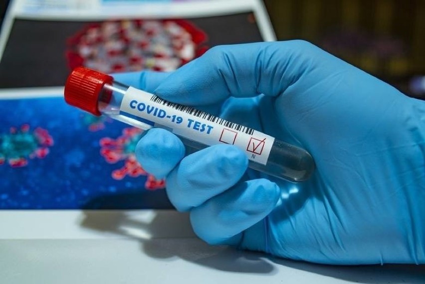 Ponad 300 nowych przypadków zakażeń koronawirusem w Lubuskiem