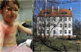 Wrocław. Rok więzienia dla przedszkolanki z Kozanowa, która ciężko poparzyła dziecko