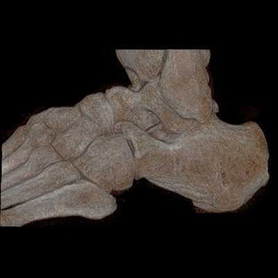 Źródło: http://commons.wikimedia.org/wiki/File:RadZepMov_CT_3D_human_Foot_Bone_SHR.jpeg
