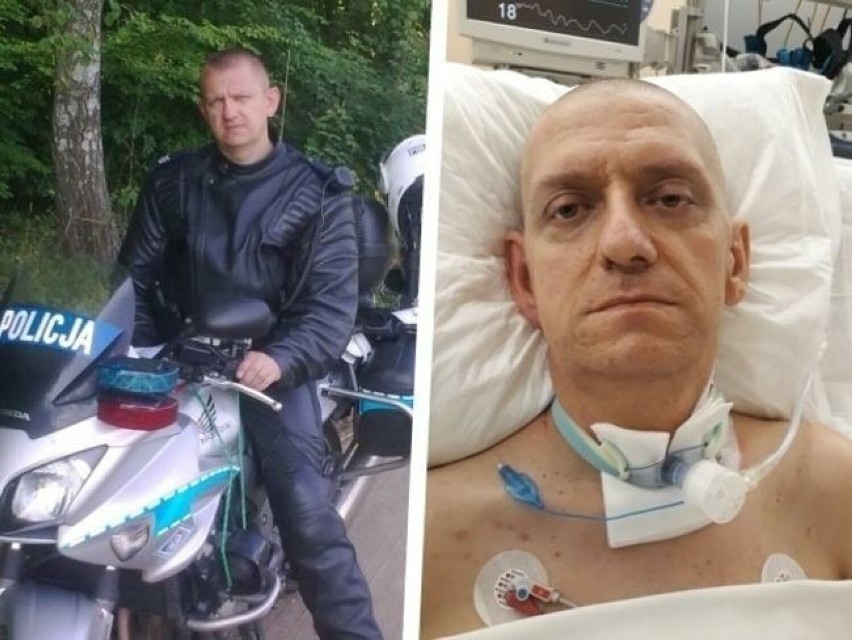 Policjant z Opoczna, który uległ wypadkowi, wciąż potrzebuje pomocy. W szpitalu odwiedził go komendant wojewódzki policji
