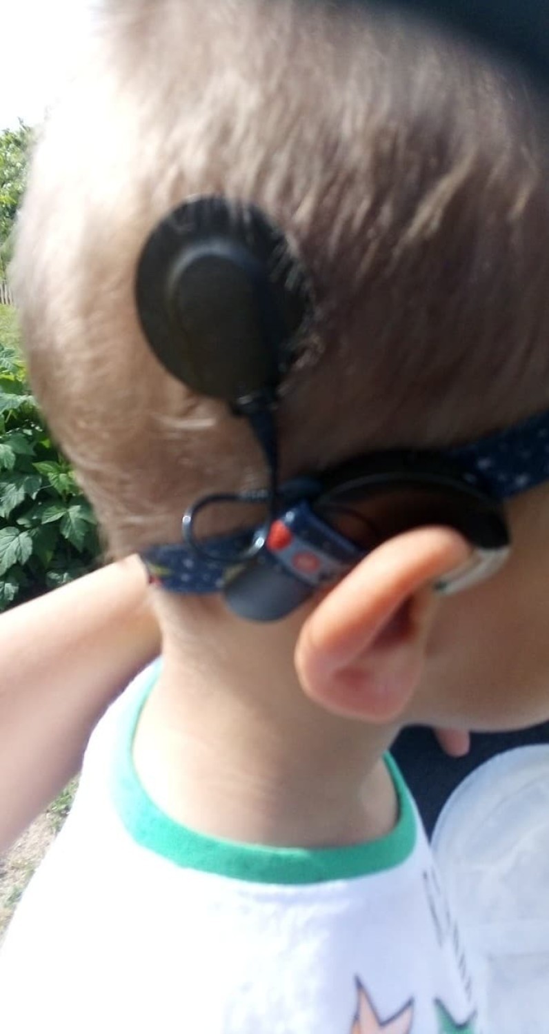 Chłopiec najpierw był wyposażony w aparaty słuchowe, ale te...