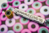 84 przypadki zakażenia koronawirusem w Wielkopolsce [20 maja]
