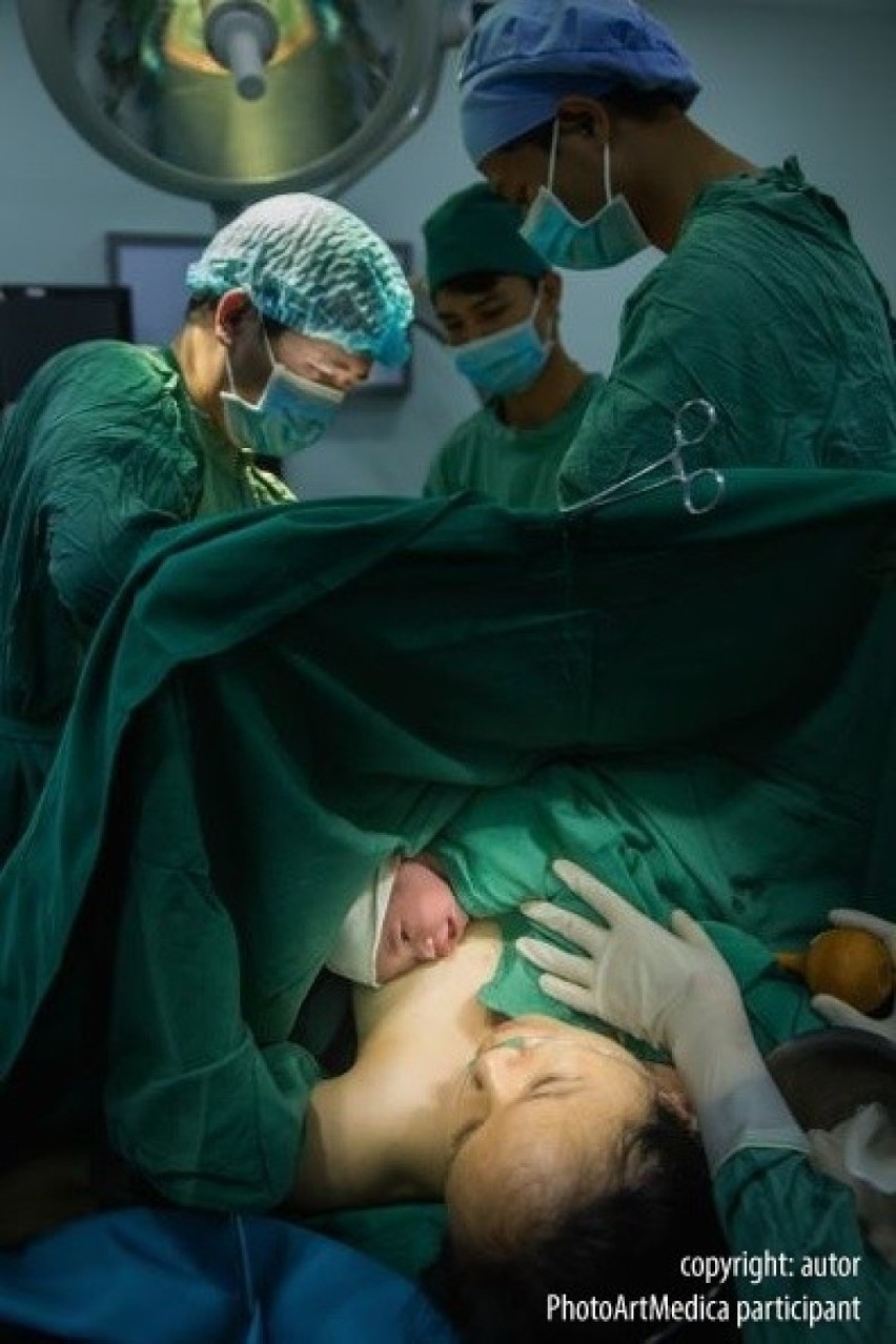 Zwycięzcą w kategorii "fotografia medyczna" został dr Trong...