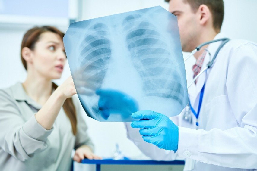 Zapalenie płuc to stan zapalny miąższu płuc, powodujący...