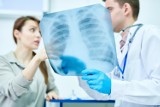 Jak rozpoznać zapalenie płuc? Objawy u dorosłych i dzieci mogą się różnić. Nie dopuść do rozwoju groźnych powikłań