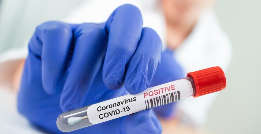 Koronawirus atakuje. Punkty pobrań wymazów wydłużają godziny pracy - informuje Narodowy Fundusz Zdrowia