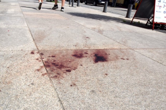 Od jednego z naszych czytelników otrzymaliśmy informacje o plamie wyglądającej jak krew przy ulicy Warszawskiej 3 w Kielcach. Skontaktowaliśmy się w tej sprawie ze Strażą Miejską.