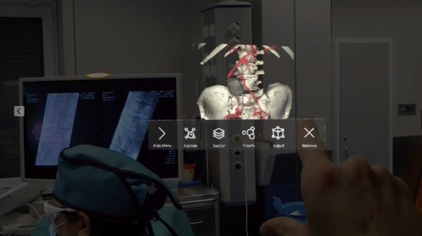 Pomorzany: Hologram na sali operacyjnej. Chirurg oglądał organy pacjenta w powietrzu [WIDEO]