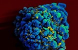 Koniec z HIV? Drugi na świecie przypadek wyleczenia wirusa
