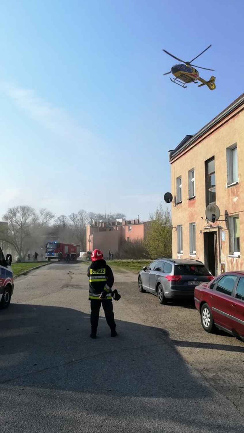 Police. Kobieta poparzona płomieniami z kuchenki. Jej stan jest ciężki  