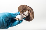 Ile jest zatruć toksynami grzybów na Pomorzu? W skali kraju jest znacznie gorzej