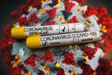 Najnowsze dane o zakażeniach koronawirusem w woj. zachodniopomorskim