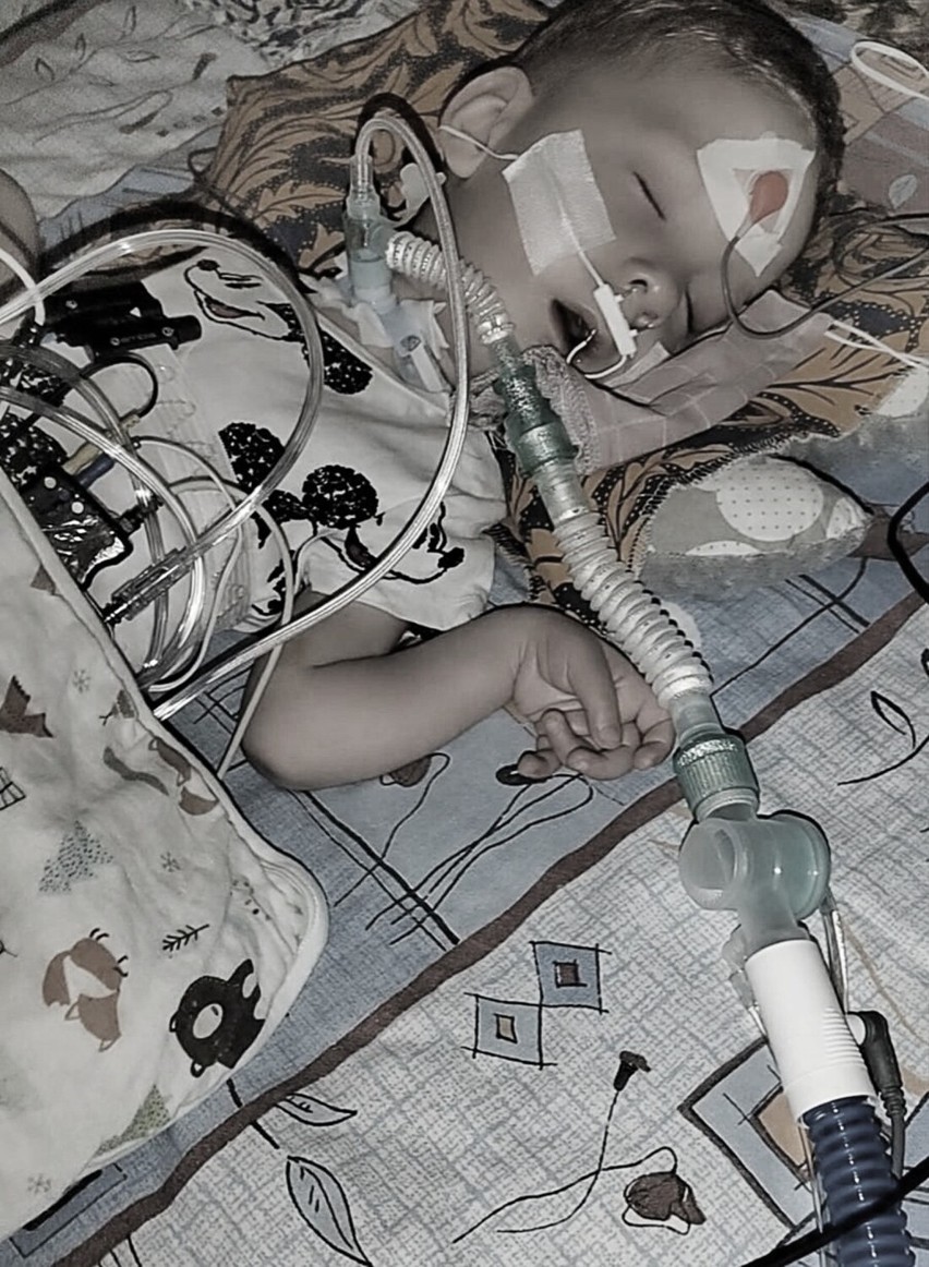 Pomóżmy Romusiowi! 2-latek walczy o życie, trwa zbiórka na jego leczenie