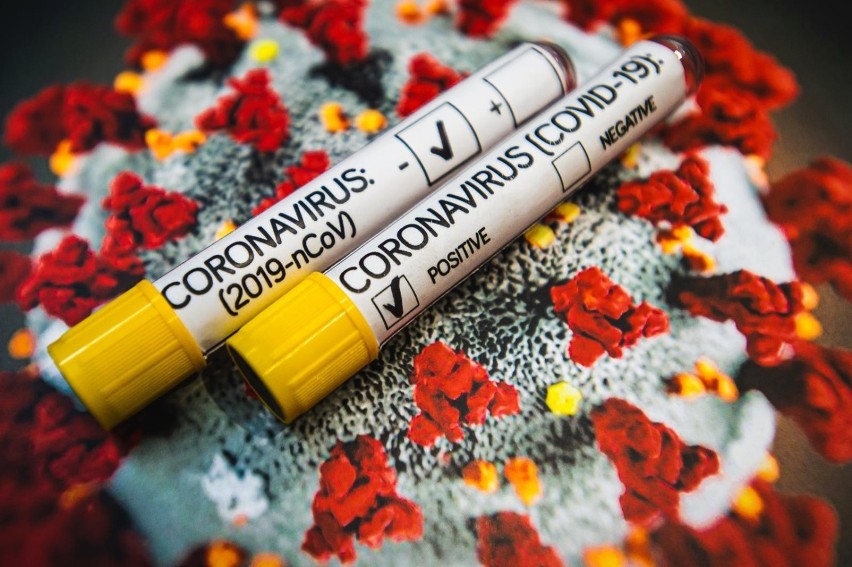 Kolejnych 5 pozytywnych wyników testów na koronawirusa w...