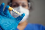 Ministerstwo Zdrowia potwierdziło 59 zakażeń SARS-CoV-2 w powiecie kwidzyńskim. Trzy osoby zmarły