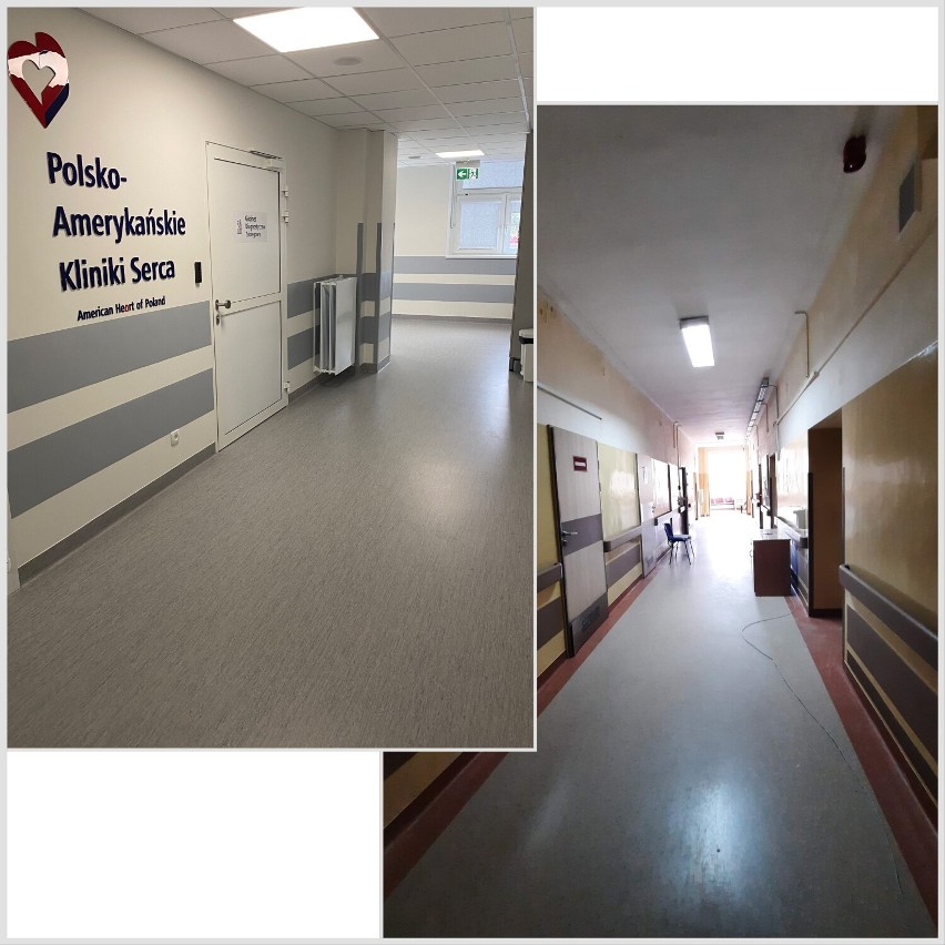7,5 mln złotych na modernizację oddziału kardiologicznego Polsko-Amerykańskich Klinik Serca w Wieluniu 