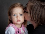 Dwuletnia Zoe walczy z niebezpiecznym nowotworem oka