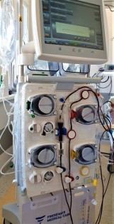 Szpital Powiatowy w Myszkowie ma nowy sprzęt medyczny 