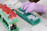 Mieszkańcy Kalwarii Zebrzydowskiej zakażeni koronawirusem mogą zgłaszać się do udziału w testach leku na COVID-19