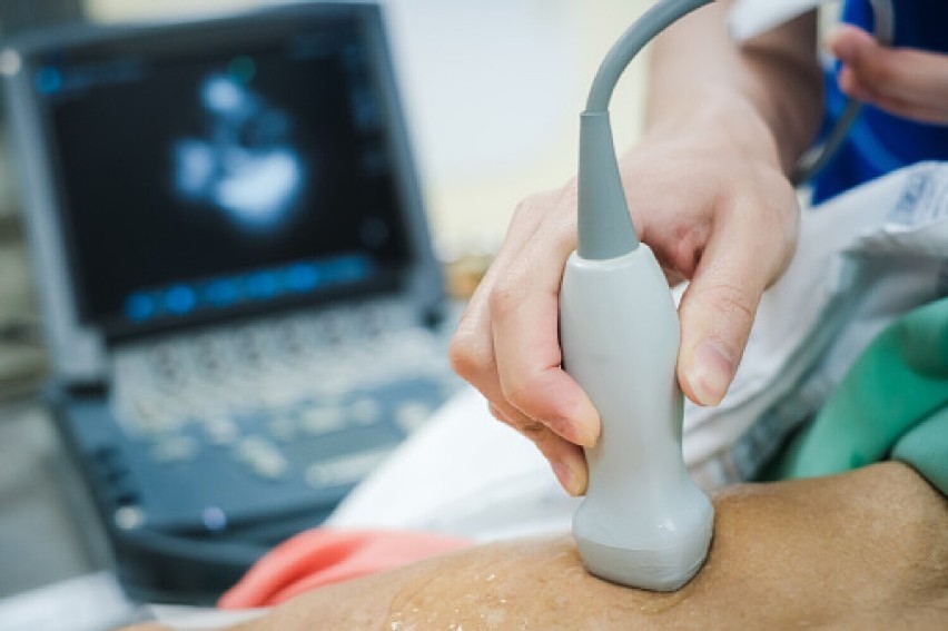 Bezpłatne badanie aorty brzusznej w szpitalu w Pile. Mogą zgłaszać się mężczyźni w wieku od 50 do 69 lat 