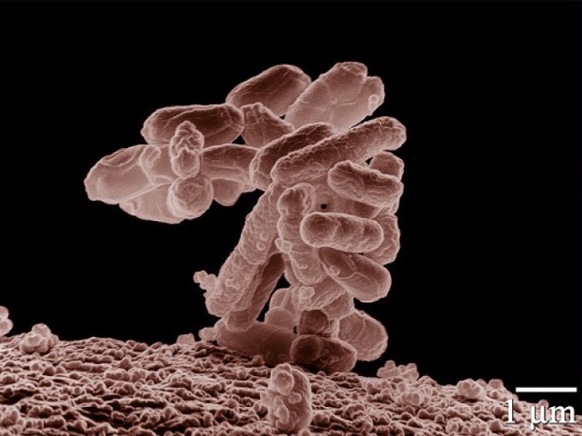 - W Polsce mamy dwa potwierdzone przypadki zarażenia bakterią ...
