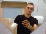 20-letni Paweł spod Stargardu w wypadku w tartaku stracił rękę. Trwa zbiórka na protezę, która kosztuje prawie pół miliona złotych