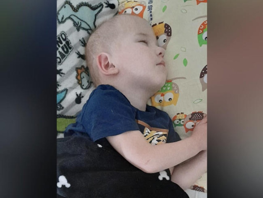 Dziecko które potrzebuje naszej pomocy. Mały Maciej walczy z nowotworem mózgu.