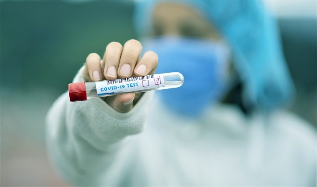 Od początku pandemii w Polsce wykryto 116.338 przypadków koronawirusa. W związku z Covid-19 zmarło 2.919 pacjentów