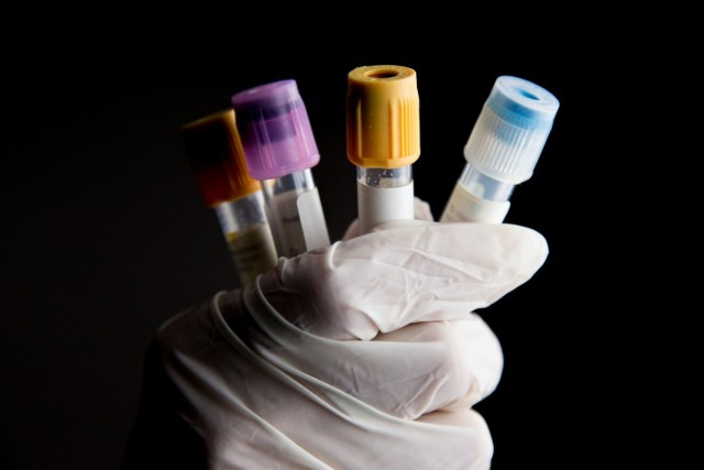 Spada liczba testów na koronawirusa w Polsce. MZ tłumaczy