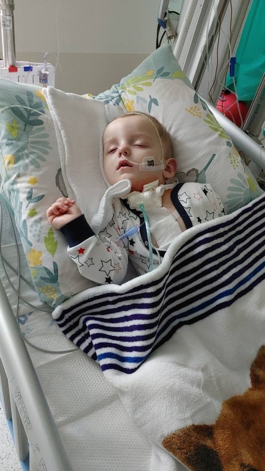 Dwuletni Michaś powoli dochodzi do zdrowia po wypadku