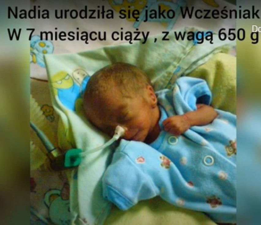 Września: Porażenie mózgowe, autyzm, guz w klatce piersiowej. Poznajcie Nadusię. POMÓŻMY, bo możemy