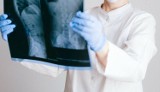 Mieszkańcy Krosna mogą zapisać się na bezpłatne badania wykrywające osteoporozę