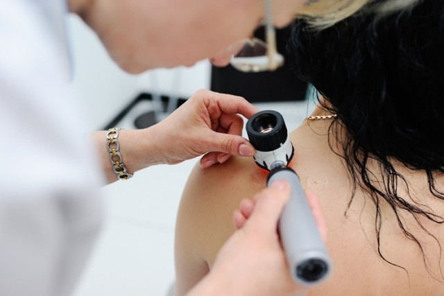 Bezpłatne badania dermatoskopem można wykonać w środę 5 lipca w siedzibie opolskiego FNZ.