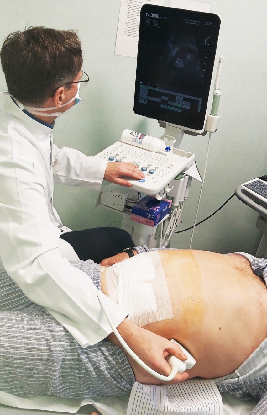 Nowy sprzęt do badań USG dla oddziału urologii w szpitalu w Krośnie pozwala na szybszą diagnostykę pacjentów z nowotworem