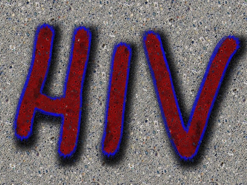 MIT: Nie wolno uprawiać seksu z osobą zakażoną wirusem HIV...