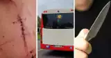 Przerażająca sytuacja w autobusie w Katowicach! Pijany zaatakował nożem nastolatka wracającego ze szkoły, chłopak ma 43 szwy na twarzy