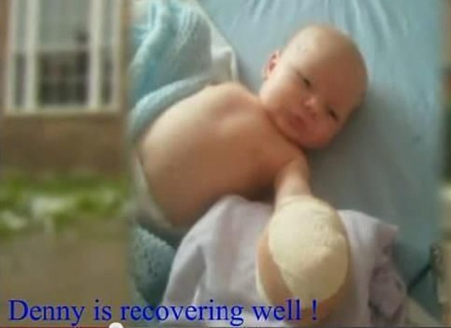 Dany, uratowany z lisiej paszczy w szpitalu po zabiegu chirurgicznym. Zdjęcia kadry z materiału Youtube