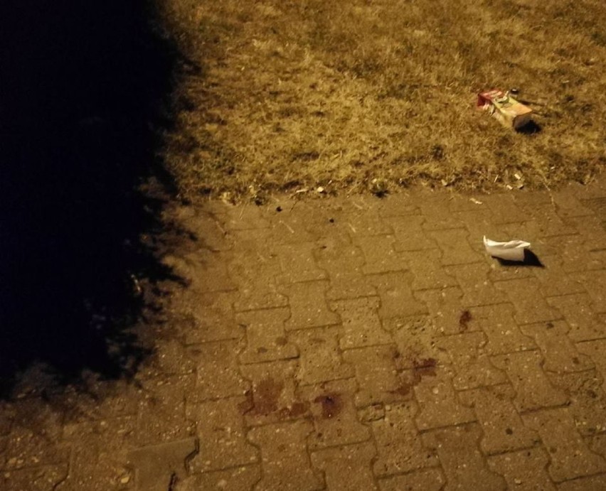 19-latek zaatakowany nożem na Placu Wolności we Włocławku przeszedł zabieg [nowe informacje]