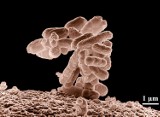 Bakteria E. coli, gronkowiec - objawy i leczenie