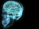 Co szósta osoba doznaje udaru mózgu. Czy możemy tego uniknąć?