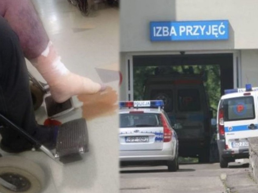 Z bolącej, sinej nogi 39-letniego mężczyzny sączyła się krew...