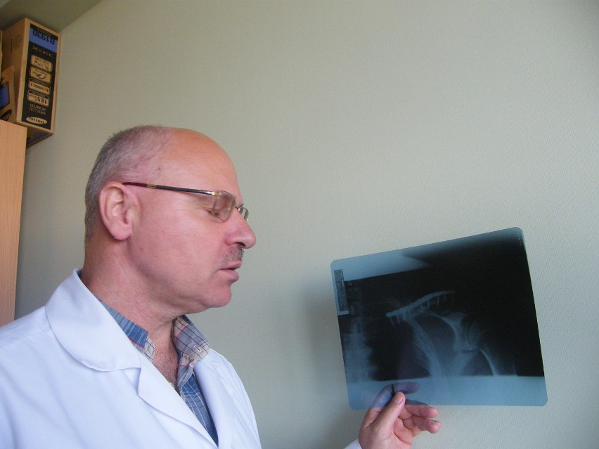 Dr Marek Kintzi pokazuje zdjęcie rtg z tytanową płytką