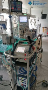 Kobieta doznała poporodowego uszkodzenia serca. Z pomocą przyszło ECMO. Krakowski Szpital im. św. Jana Pawła II korzysta z niego od lat