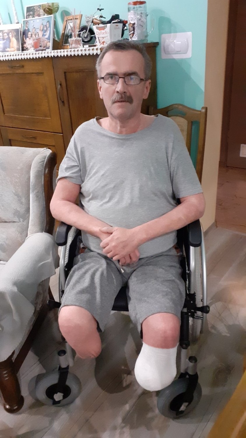 Pan Ryszard z Wągrowca w wyniku choroby stracił obie nogi. Pilnie potrzebuje naszej pomocy 