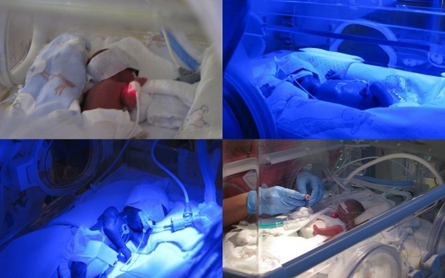 Czworaczki, które w poniedziałek urodziły się w szpitalu w Rudzie Ślaskiej