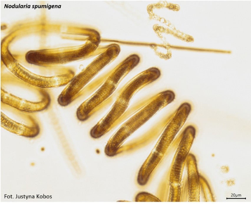 Tak wygląda sinica pod mikroskopem – gatunek Nodularia...
