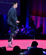 Bioniczne kończyny odmienią życie wielu osób niepełnosprawnych? (wideo)