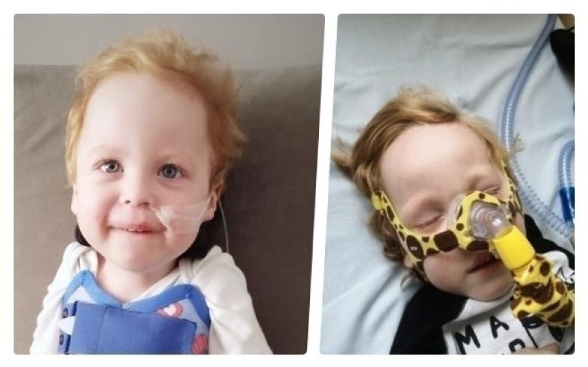 Trwa zbiórka pieniędzy na pomoc dla 3-letniego Wiktorka Szczechowiaka w walce z ciężką chorobą. Potrzeba 9 milionów złotych